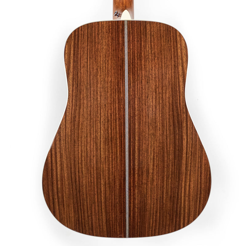 Martin HD-28E, LR Baggs Electronics
